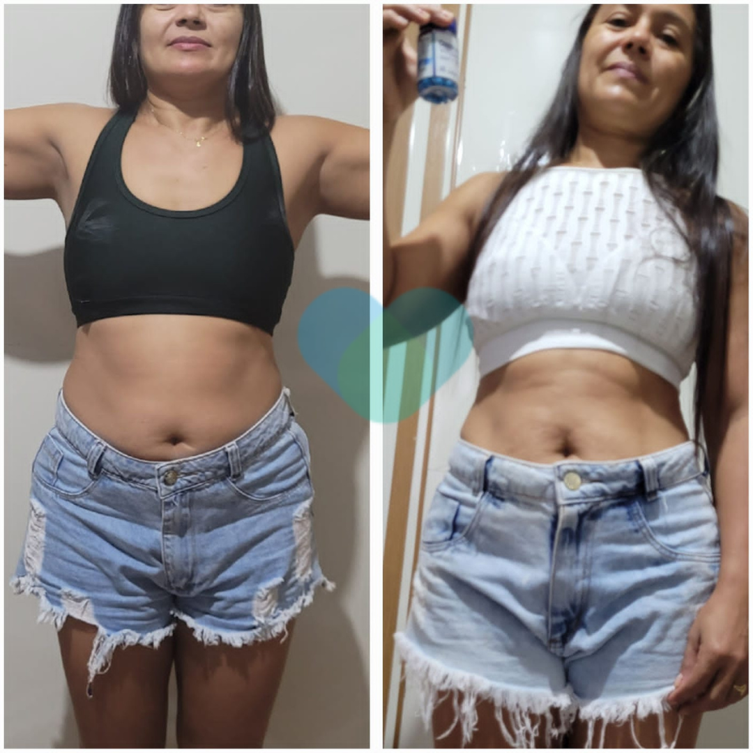Antes e depois 1 (substitua)